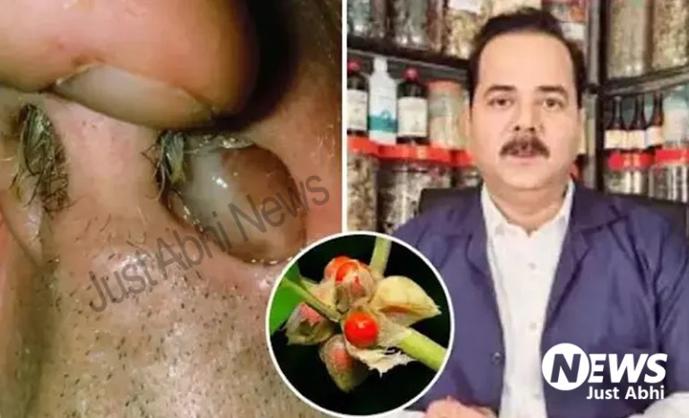 नाक का मांस बढ़ गया, कम आ रही सांस? Dr. इरफान ने बताया देसी नुस्खा, 15 दिन में ठीक हो जाएगी बढ़ी हुई हड्डी, ☉