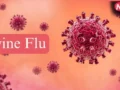 Swine Flu Prevention: बारिश के मौसम में क्यों बढ़ जाता है स्वाइन फ्लू का खतरा? जानें कैसे करें बचाव​