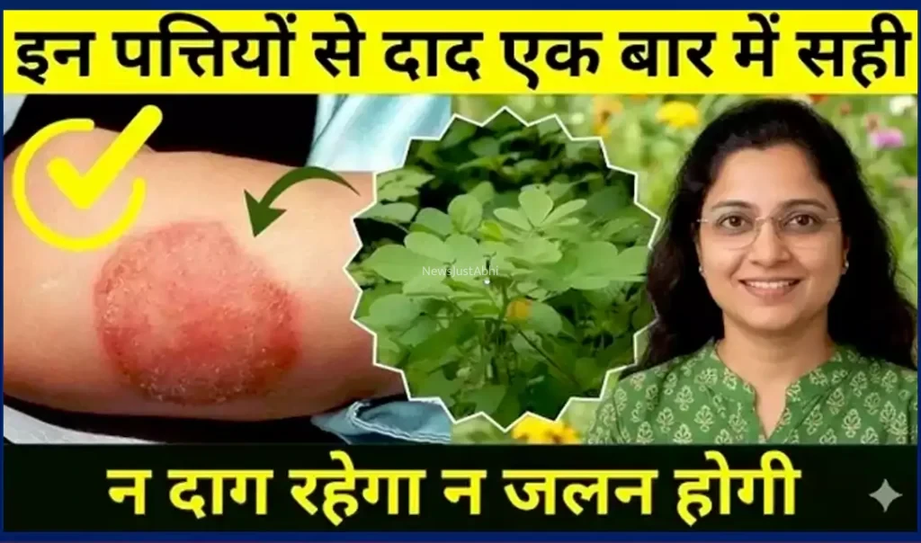 दाद को जड़ से मिटाने वाला शक्तिशाली आयुर्वेदिक नुस्खा, विस्तार में जानें इसके बारे में