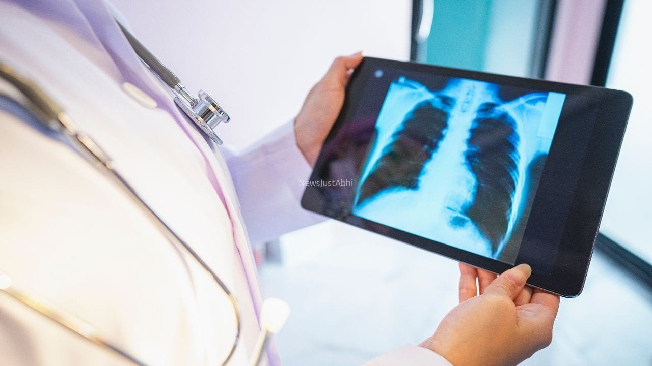World Lung Cancer Day: किन लोगों को लंग कैंसर स्क्रीनिंग करवानी चाहिए और क्यों? एक्सपर्ट्स ने बताया​