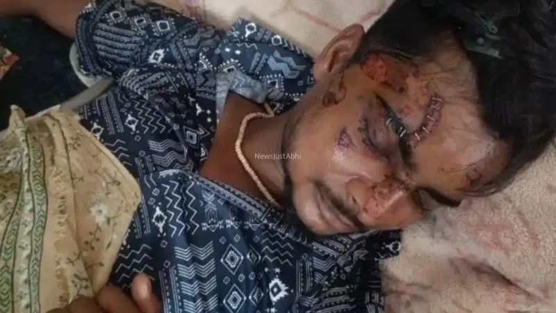 जेब में रखा Motorola फोन अचानक फटा, बुरी तरह झुलसा युवक, डॉक्टर ने टांकों की जगह लगा दिए स्टेपलर पिन