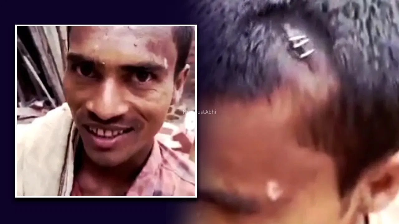 सिर फटा था… डॉक्टर ने स्टेपलर चला दिया! डॉक्टर या मजाक?…,नवादा में झोलाछाप डॉक्टर का अजीब इलाज वायरल