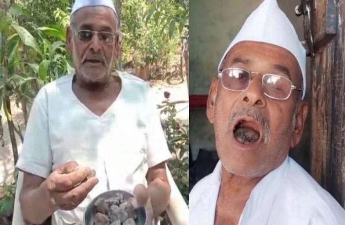 ​​ये हैं 80 साल के पत्थर वाले बाबा, एक दिन में चट कर जाते हैं 250 ग्राम पत्थर​​​