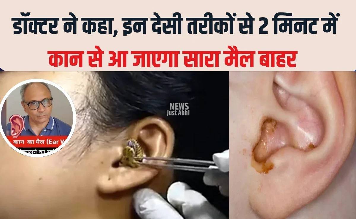 2 मिनट में कान का मैल आ जाएगा बाहर, सरसों के तेल में बस यह सफेद चीज मिलाकर डालें