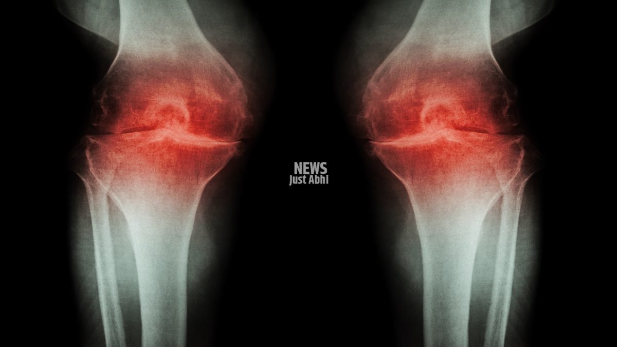 knee-osteoarthritis